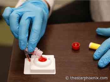 Saskatchewan reports record number of HIV cases in 2021