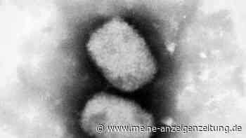 Affenpocken: Zwei weitere Fälle in Deutschland bestätigt