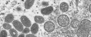 Un premier cas de variole du singe en Suisse et en Grèce