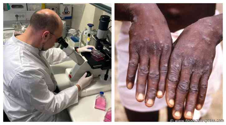 Monkeypox live symptoms and cases WHO latest updates monkeypox virus in Europe US India Spain Canada UK
