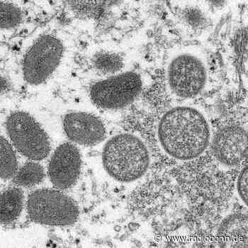 Drei Affenpocken-Fälle in Deutschland - Radio Bonn / Rhein-Sieg - radiobonn.de
