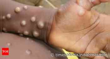 92 monkeypox cases confirmed in 12 countries, may spread globally: WHO