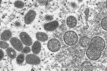 Toronto health authorities investigate first suspected monkeypox case - Prince George Citizen