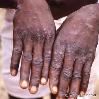 Victorian Chief Health Officer Professor Brett Sutton issues monkeypox warning - Drive - ABC News