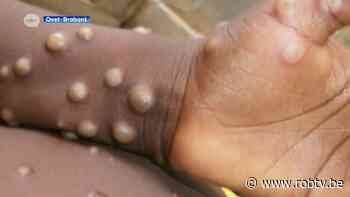 Man uit onze regio besmet met apenpokkenvirus, Marc Van Ranst: "Moeilijk om te zeggen of dit nieuwe pandemie is" - ROB-tv