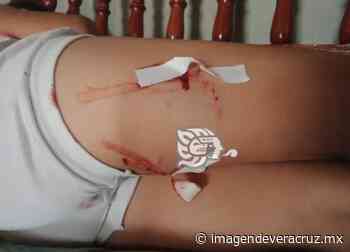 Menor es atacada por un perro en Misantla - Imagen de Veracruz