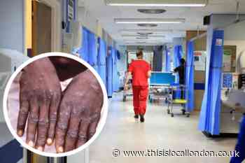 Monkeypox: New guidance released as close contacts isolate for 3 weeks