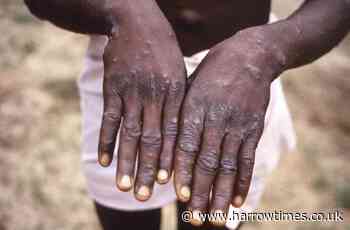 What is monkeypox and why should you be concerned?