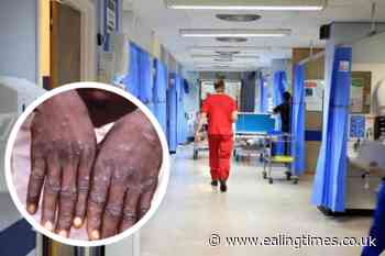Moneypox: New guidance released as close contacts isolate for 3 weeks - Ealing Times