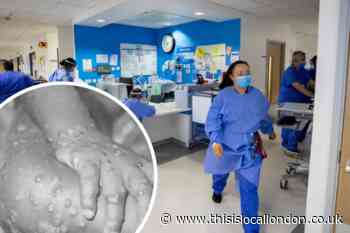Monkeypox symptoms in humans amid new UK guidance as cases rise - what we know