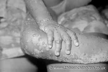 Monkeypox cases rise by 36 in the UK,  raising total to 56