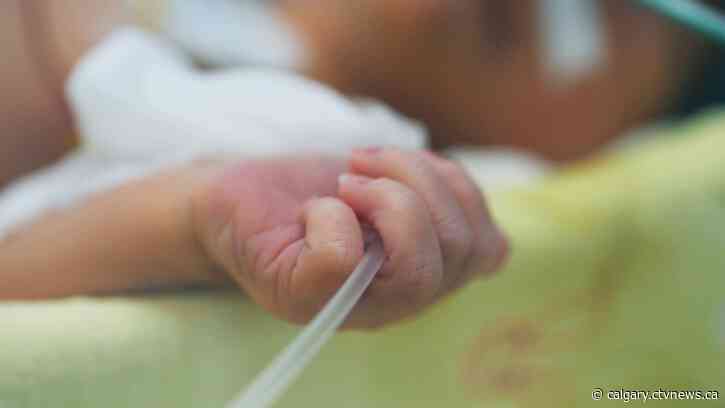 1 of 3 Alberta children hospitalized with severe acute hepatitis has been released