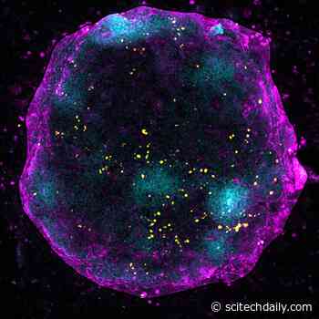 Discovery of “Yoyo” Mechanism: Turning X Chromosome “Off and On Again” Critical for Oocyte Development