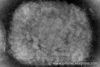 Canada considering smallpox vaccine for monkeypox cases, says Dr. Theresa Tam - Omineca Express