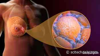 Scientists Discover “Crown-Like Structures” Surrounding Breast Tumors Could Hinder Cancer Therapy