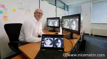 Pourquoi l’imagerie médicale intelligente de Median sur-performe