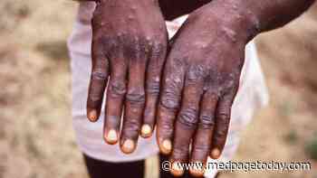 Name That Rash: Is It Monkeypox?
