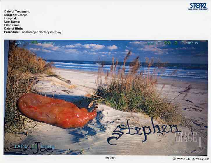 Removed Organs Star in Doctor-Turned-Artist’s Bizarre New York Show