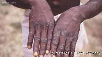 CDC says spread of monkeypox likely to happen