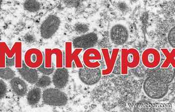 Monkeypox outbreak prompts alert for gay, bi men - Bay Area Reporter, America's highest circulation LGBT newspaper