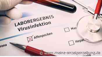 Weltweite Ausbreitung von Affenpocken: Saarland bereitet sich auf den Notfall vor