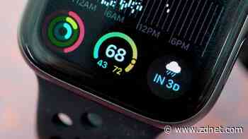 How to change the Apple Watch band