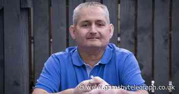 Man has double hand transplant in 'world first' for scleroderma patient - Grimsby Live - Grimsby Live