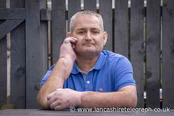 Man undergoes 'world first' double hand transplant for scleroderma