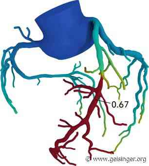 Geisinger Medical Center Muncy adopts novel technology to improve cardiac imaging - Geisinger