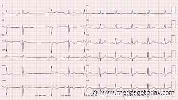 Brief Afib Not One and Done After Pneumonia