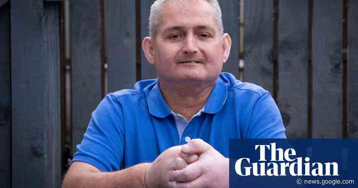 NHS performs world’s first double hand transplant for scleroderma - The Guardian