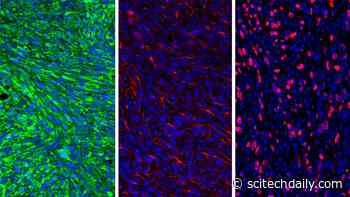 Outsmarting Brain Cancer: Using a Nanoparticle and Inhibitor To Trigger the Immune System