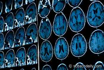 The First-Ever Treatment for Non-Metastatic Brain Tumors