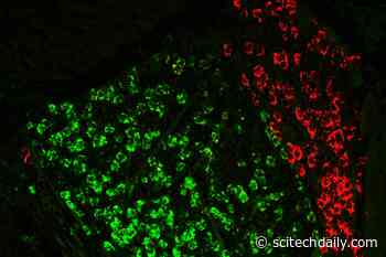 MIT Researchers Identify Brain Circuit in the Thalamus That Helps Us Hold Information in Mind