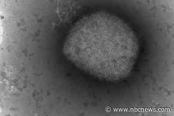 Nine monkeypox cases identified in U.S.: What we know about each of them