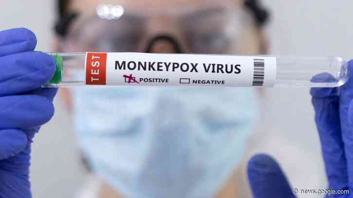 How to protect yourself against monkeypox and what to do if you catch it - CNBC