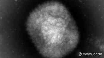 Affenpocken in Ansbach? Landkreis-Bewohner in Isolation - br.de