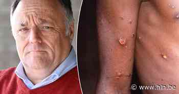 Laboratorium van Marc Van Ranst (KU Leuven) ontdekt “handvol mutaties” in apenpokkenvirus - Het Laatste Nieuws