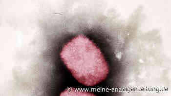 Affenpocken breiten sich weiter aus: EU will gemeinsam Impfstoff beschaffen