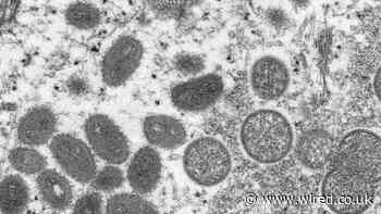 Everything You Need to Know About Monkeypox