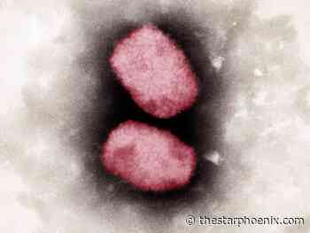 Saskatchewan on lookout for monkeypox, no cases found