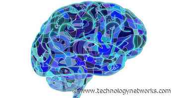 New Technique Reveals Architecture of the Resting Brain - Technology Networks