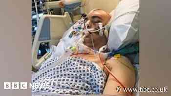 'Vicious' pair who left man in coma given suspended sentences