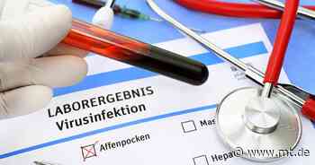 Kann man sich in Minden mit Affenpocken infizieren? Experte Dr. Witte klärt auf - Mindener Tageblatt