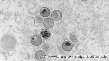 Affenpocken breiten sich aus: Weitere Fälle in Deutschland und Europa