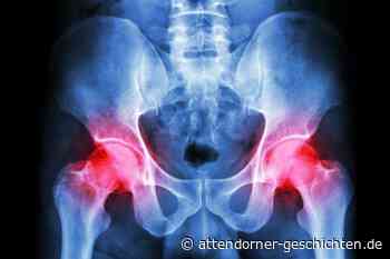 Hüftgelenkverschleiß - Wenn das Gehen nicht mehr geht • Attendorner Geschichten - Attendorn News - Attendorner Geschichten