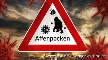 Affenpocken: Schützt es, wenn ich schon Windpocken hatte?