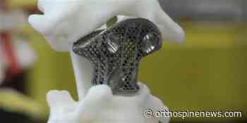 3D Printed Medical Devices Global Market Report 2022 - OrthoSpineNews