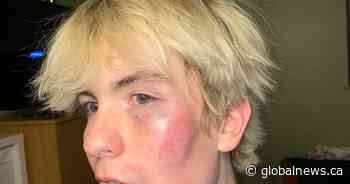 Assault charge laid in alleged homophobic beating of Nanaimo student - Global News