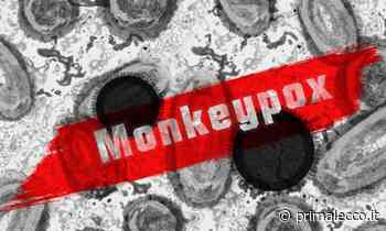 Vaiolo delle scimmie, un caso in Brianza - Prima Lecco